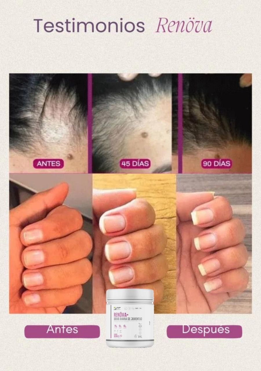 Testimonio Carla R.